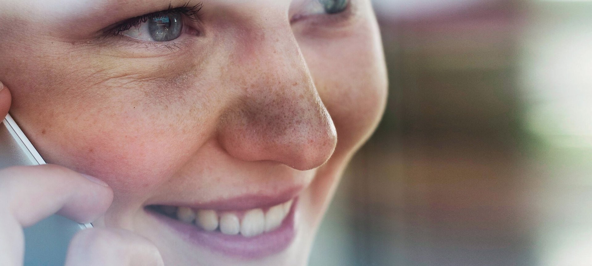 Penyebab Bintik Hitam Di Wajah Dan Cara Memudarkannyaa